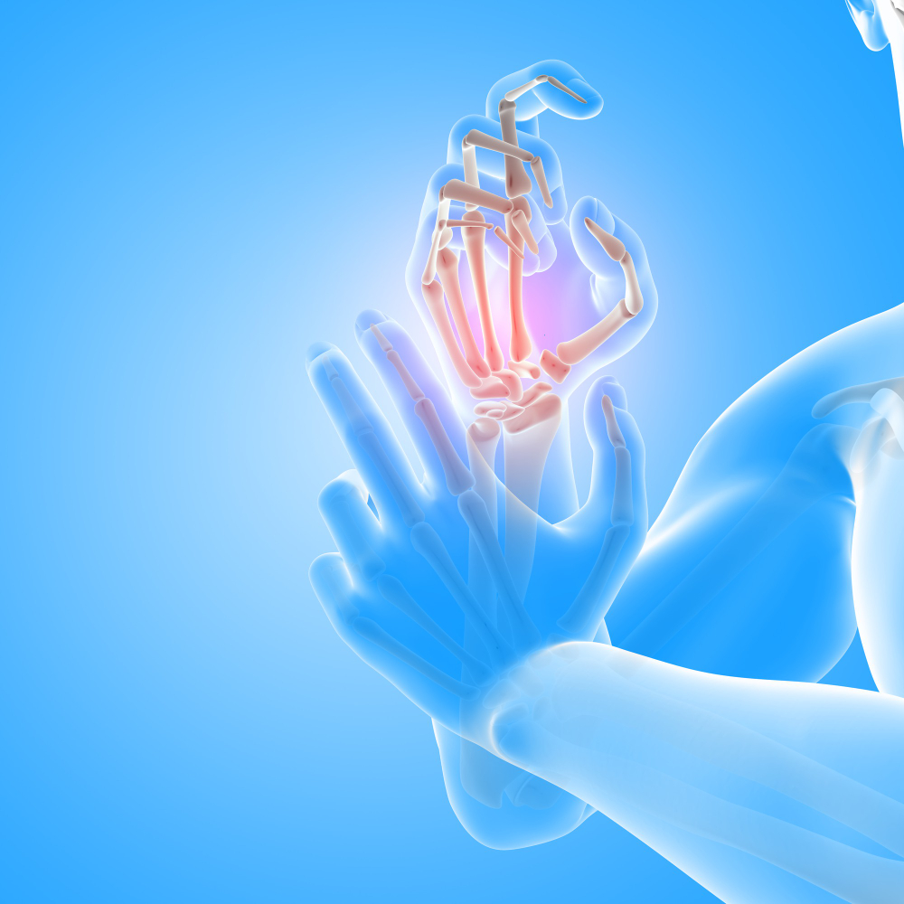 Desgaste articular